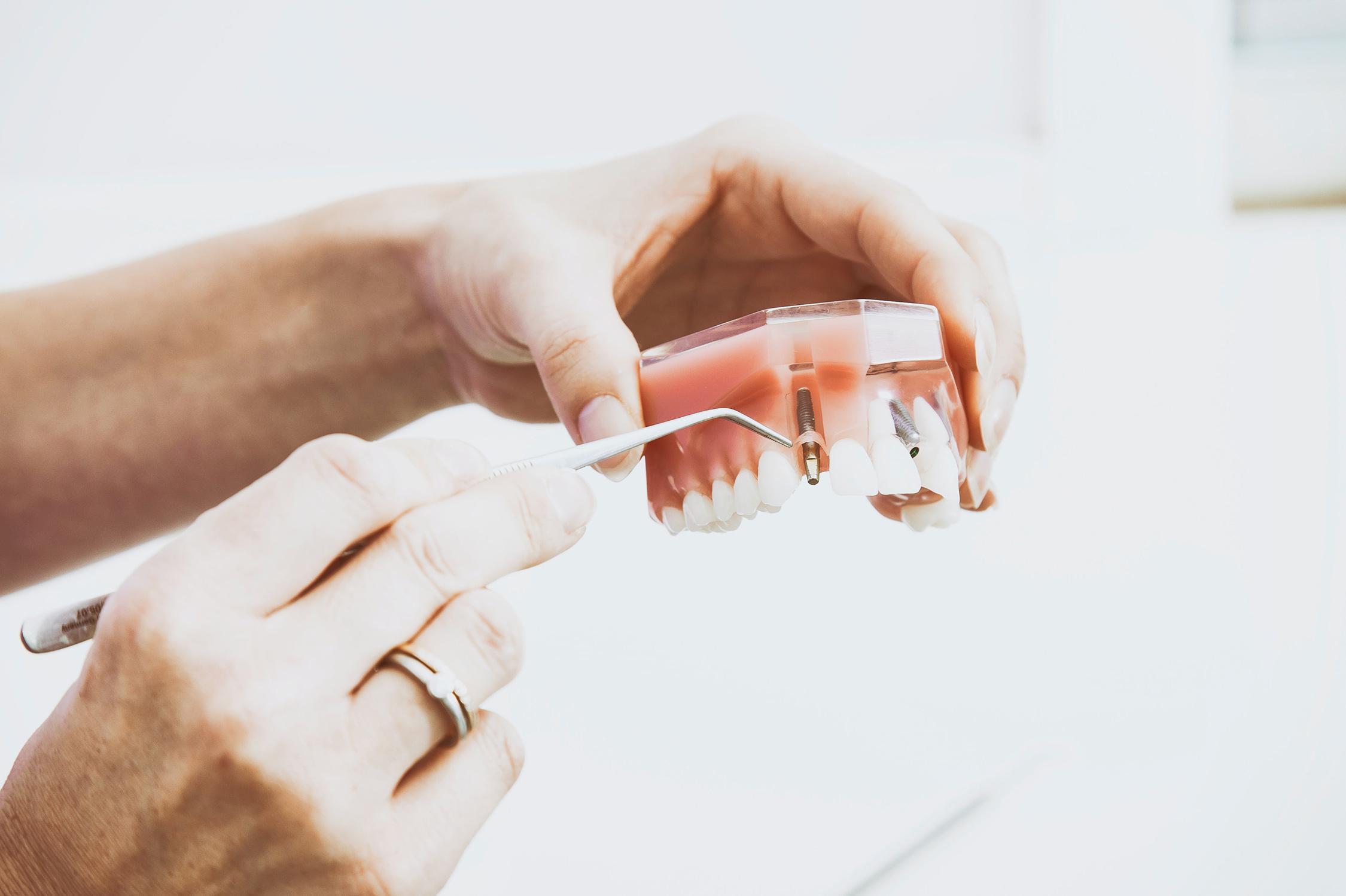 Maffei Medical | Dentista a Siena, interventi per la rigenerazione ossea
